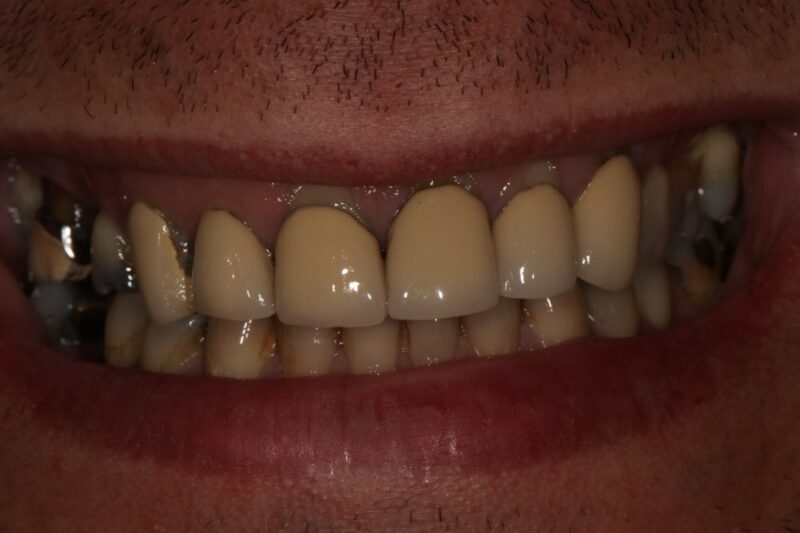 Before - Cheadle Hulme Dental