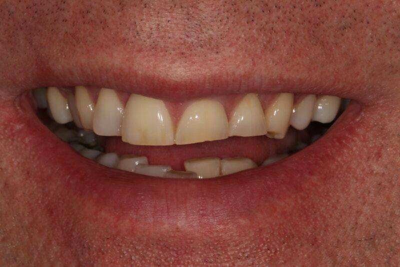 Before - Cheadle Hulme Dental