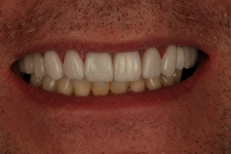 After - Cheadle Hulme Dental