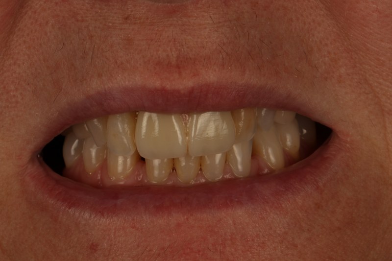 After - Cheadle Hulme Dental