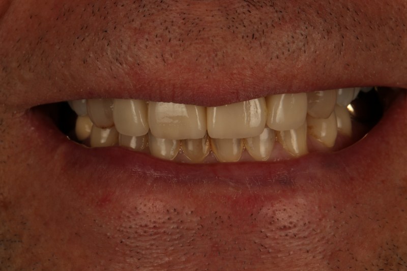 After - Cheadle Hulme Dental