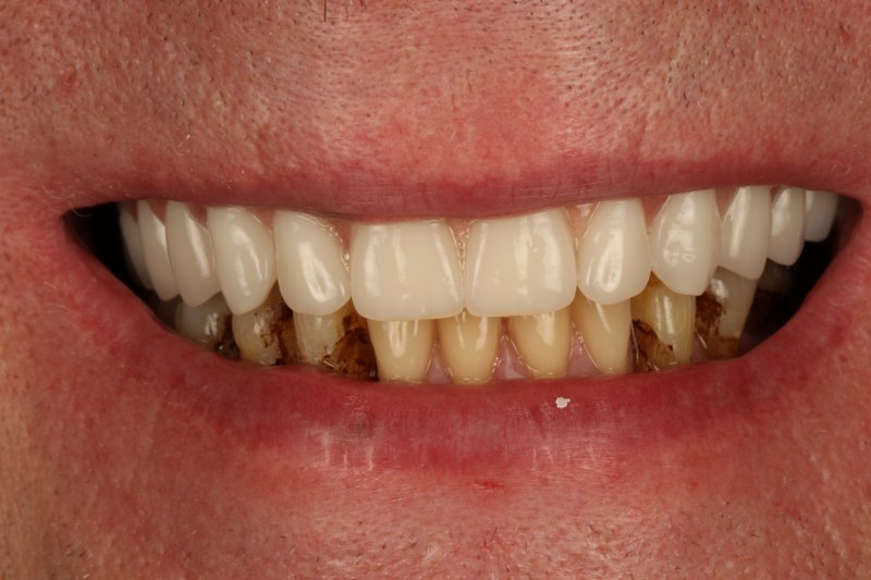 After - Cheadle Hulme Dental