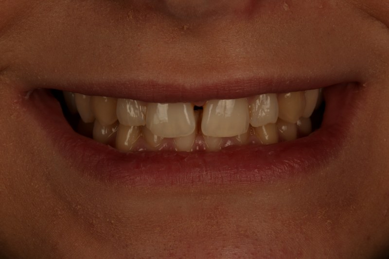 Before - Cheadle Hulme Dental