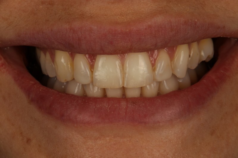 After - Cheadle Hulme Dental