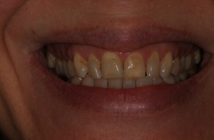 Before - Cheadle Hulme Dental