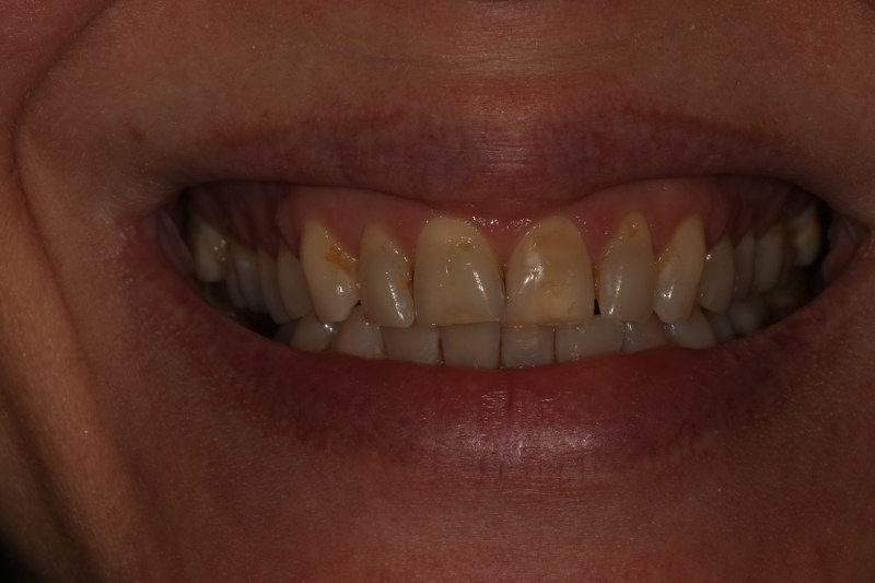 Before - Cheadle Hulme Dental