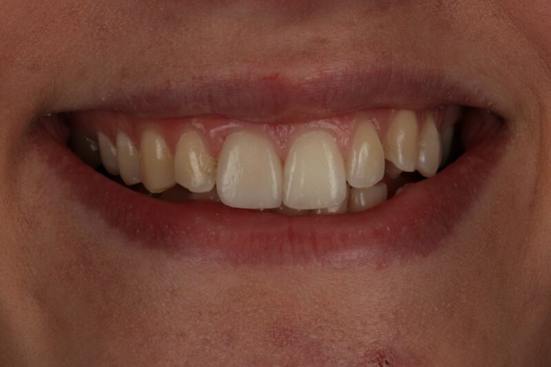 After - Cheadle Hulme Dental