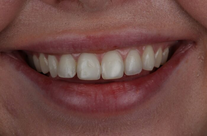 After - Cheadle Hulme Dental