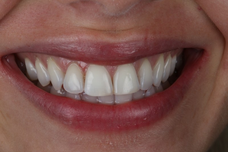 After - Cheadle Hulme Dental