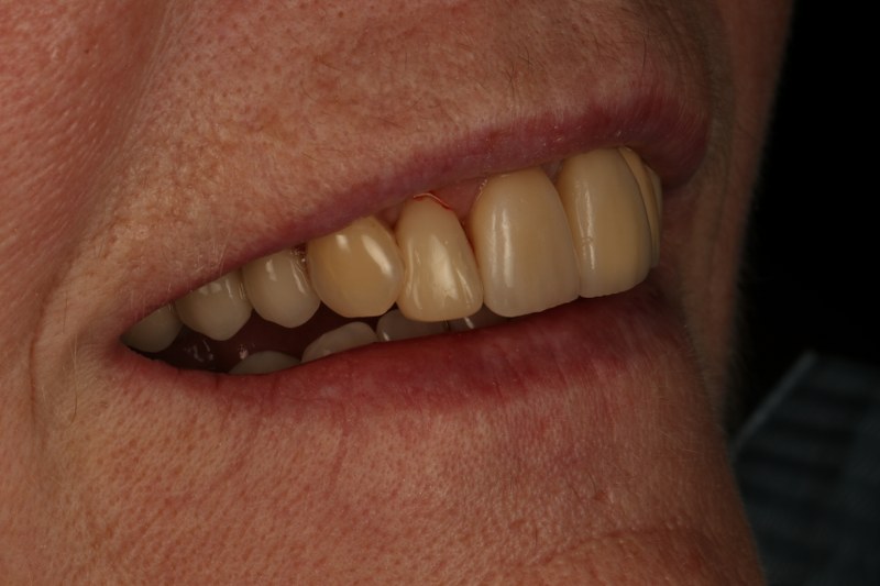 After - Cheadle Hulme Dental