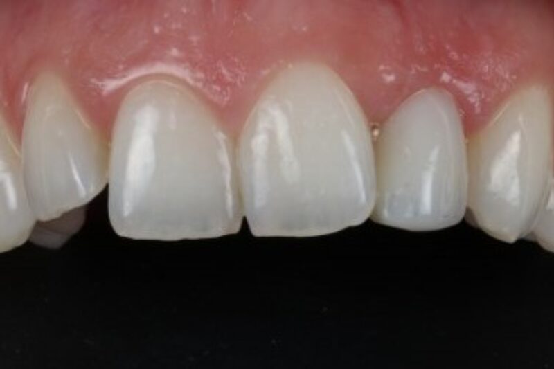 After - Cheadle Hulme Dental