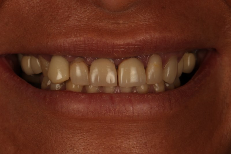 Before - Cheadle Hulme Dental