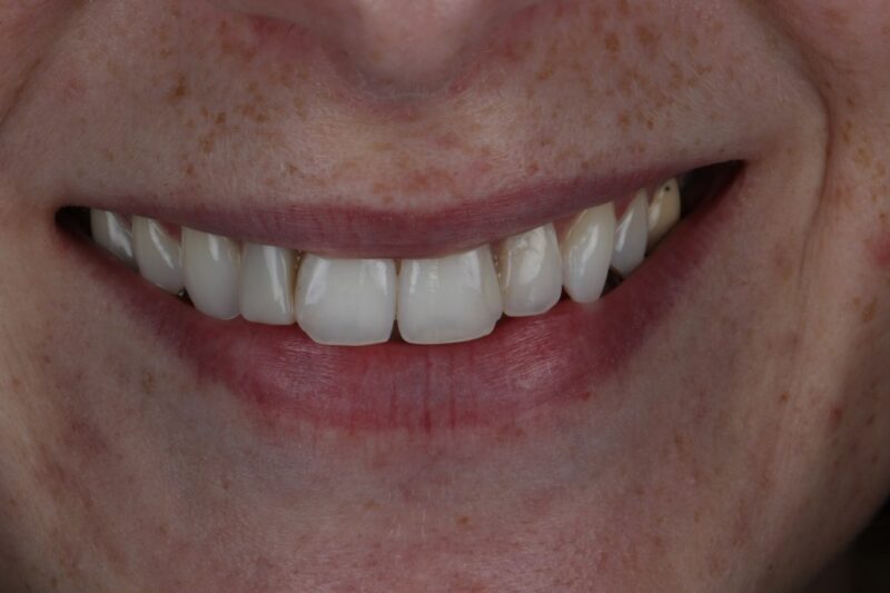 After - Cheadle Hulme Dental