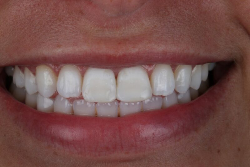 After - Cheadle Hulme Dental