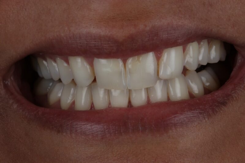 Before - Cheadle Hulme Dental