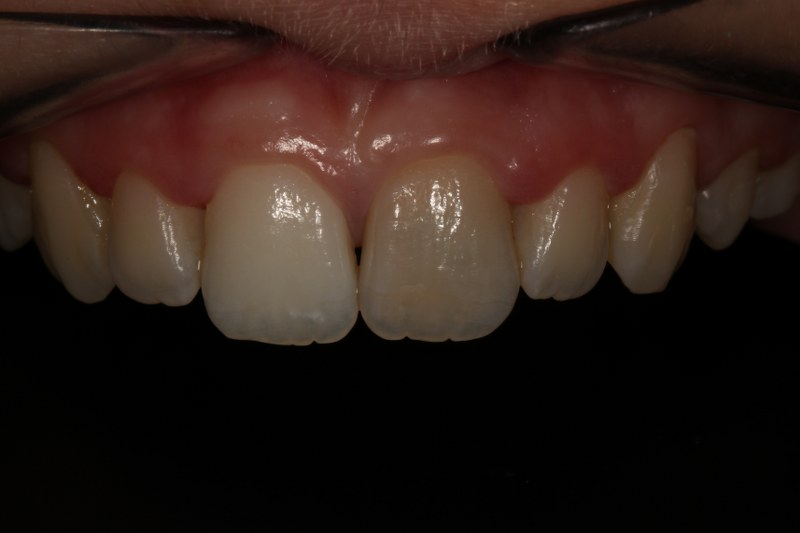 Before - Cheadle Hulme Dental