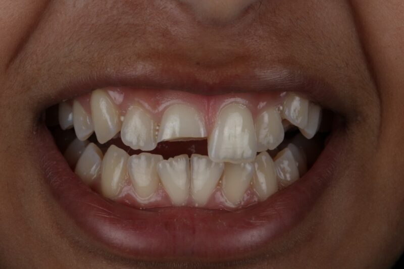 Before - Cheadle Hulme Dental