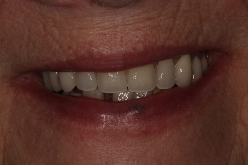 After - Cheadle Hulme Dental