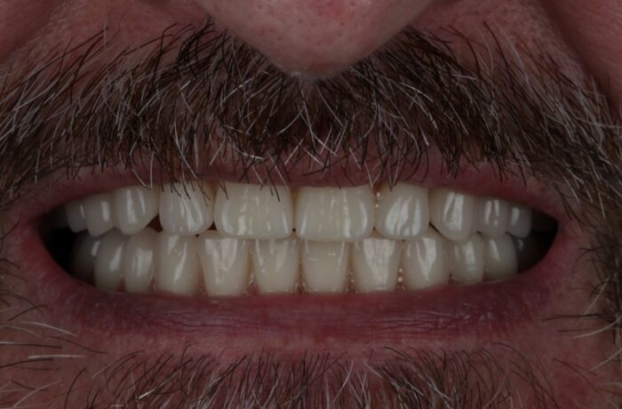 After - Cheadle Hulme Dental