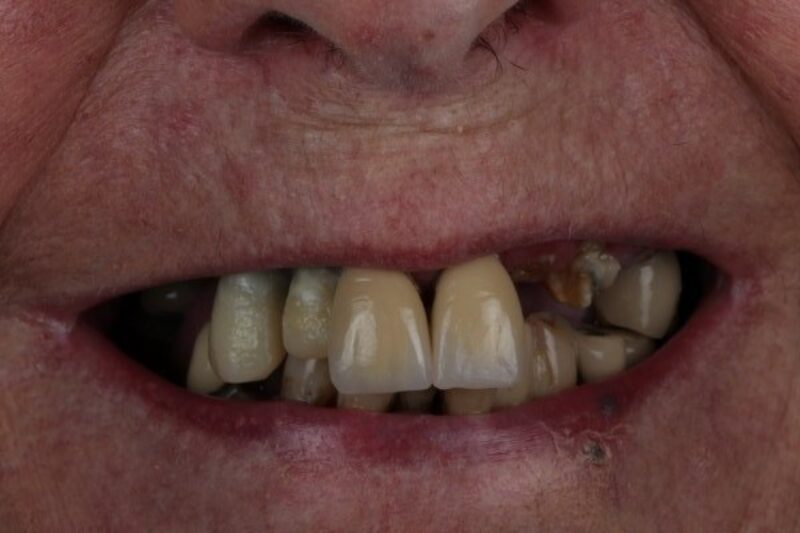 Before - Cheadle Hulme Dental