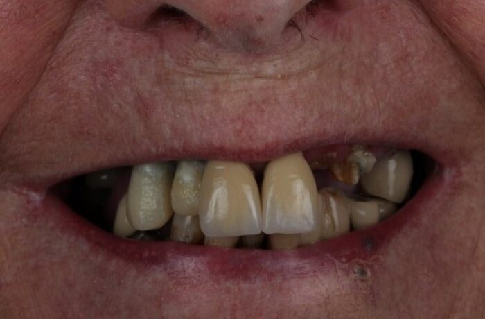 Before - Cheadle Hulme Dental