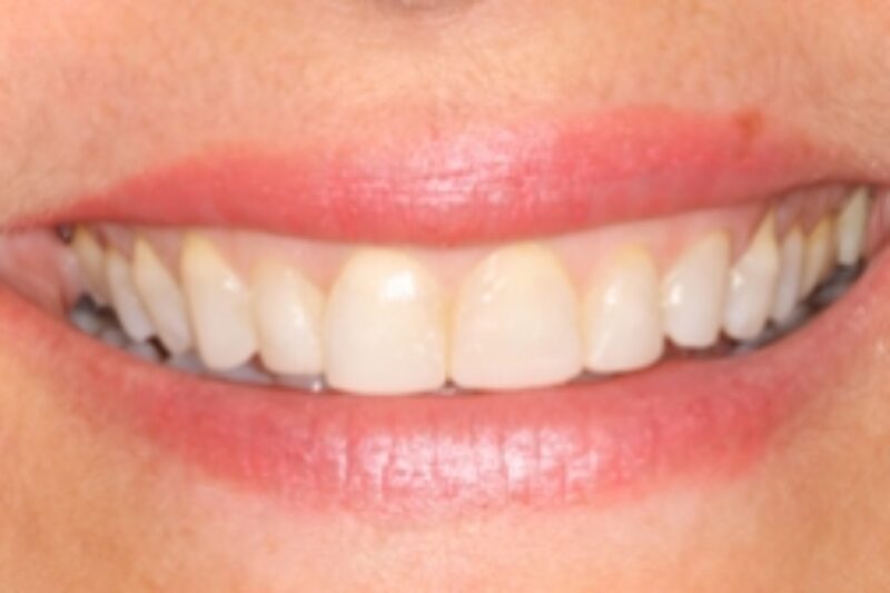 After - Cheadle Hulme Dental