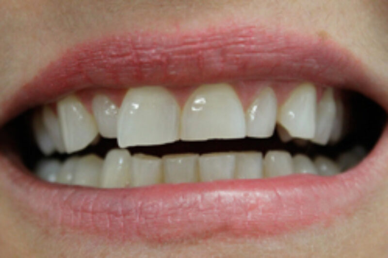 Before - Cheadle Hulme Dental