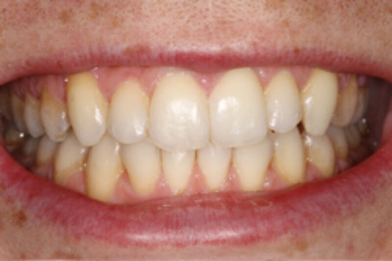 After - Cheadle Hulme Dental