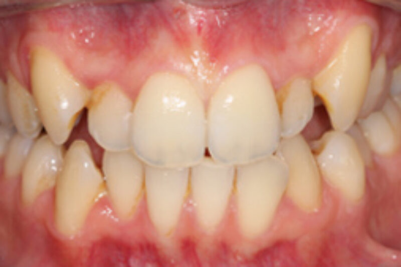 Before - Cheadle Hulme Dental