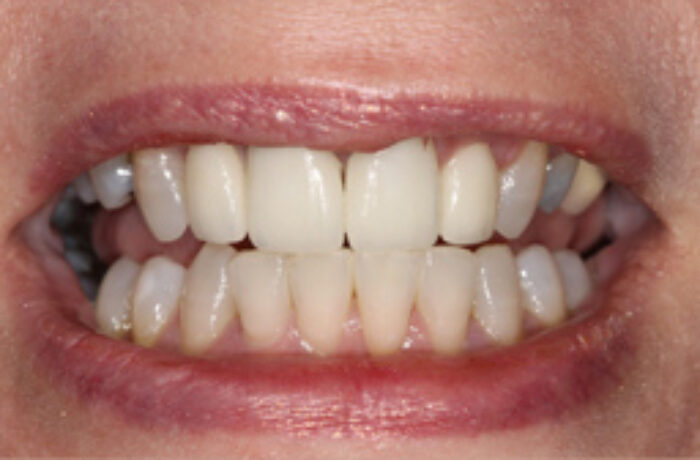 After - Cheadle Hulme Dental