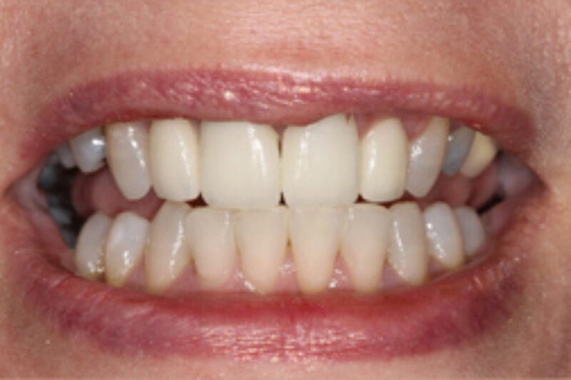 After - Cheadle Hulme Dental