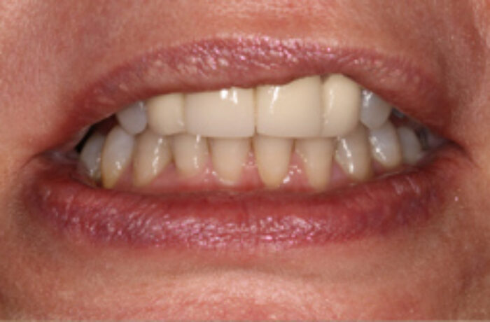 Before - Cheadle Hulme Dental