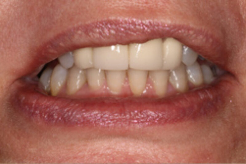 Before - Cheadle Hulme Dental