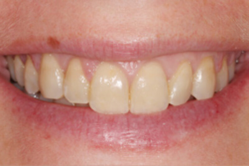 After - Cheadle Hulme Dental