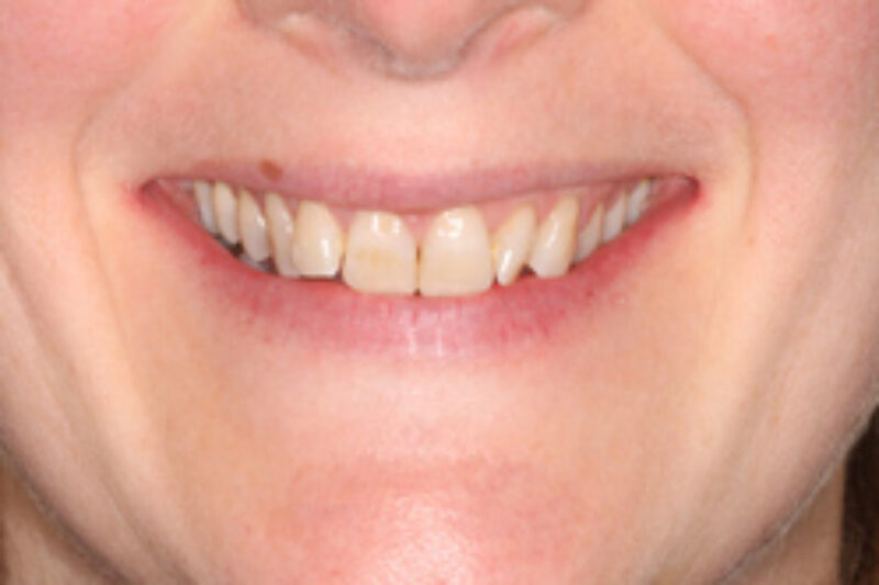 Before - Cheadle Hulme Dental