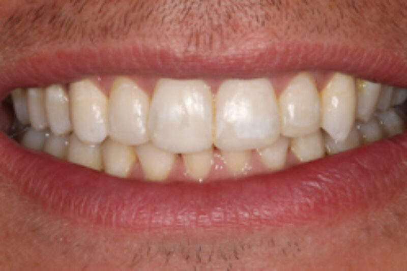 After - Cheadle Hulme Dental