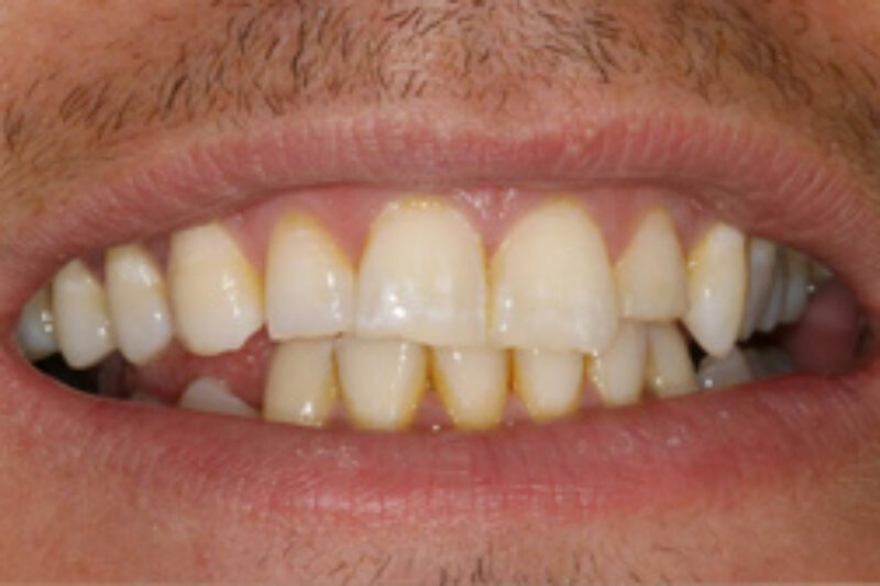 Before - Cheadle Hulme Dental