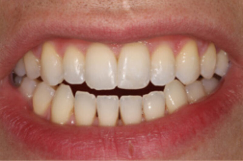 After - Cheadle Hulme Dental