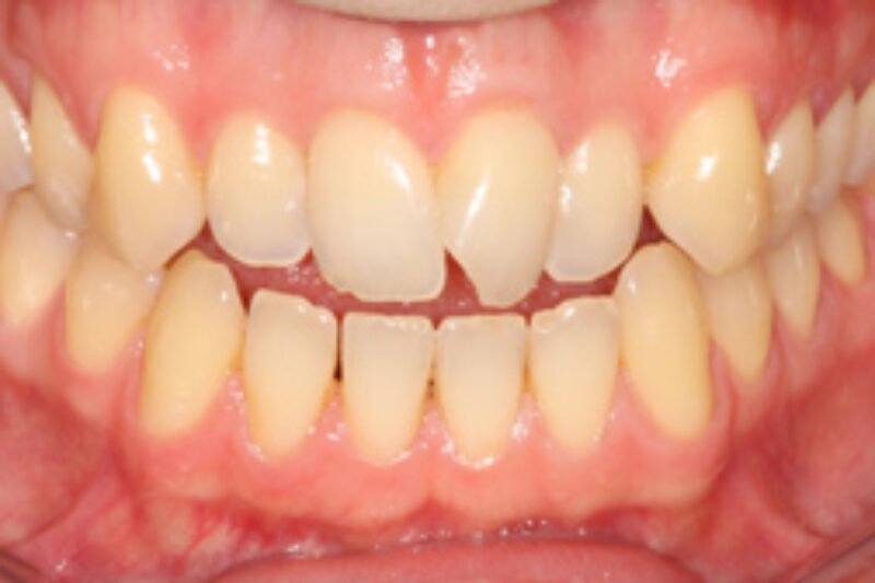 Before - Cheadle Hulme Dental