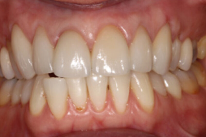 After - Cheadle Hulme Dental