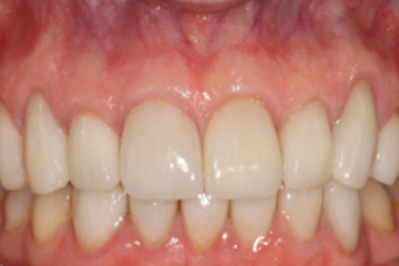 After - Cheadle Hulme Dental