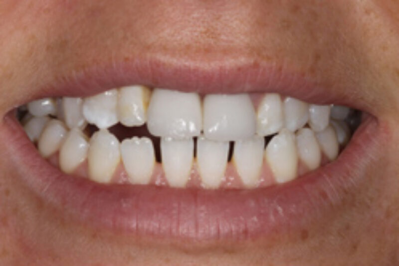 After - Cheadle Hulme Dental