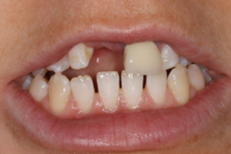 Before - Cheadle Hulme Dental