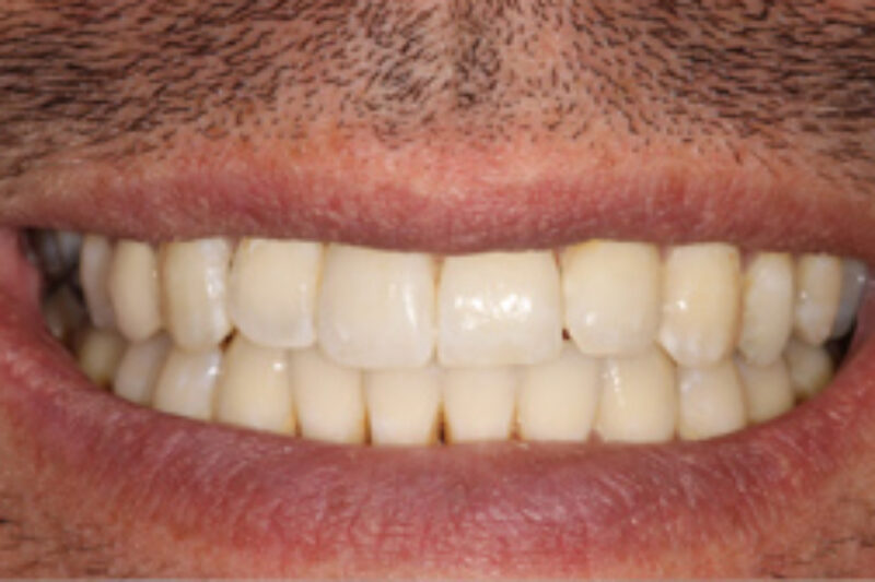 After - Cheadle Hulme Dental