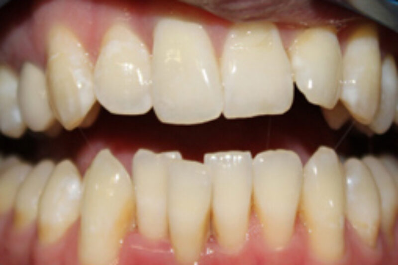 Before - Cheadle Hulme Dental