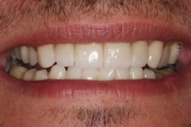 After - Cheadle Hulme Dental