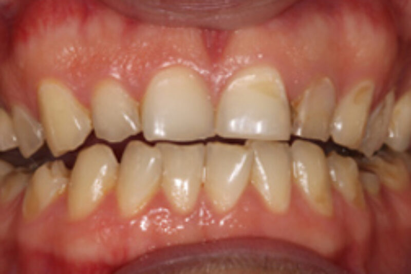 Before - Cheadle Hulme Dental