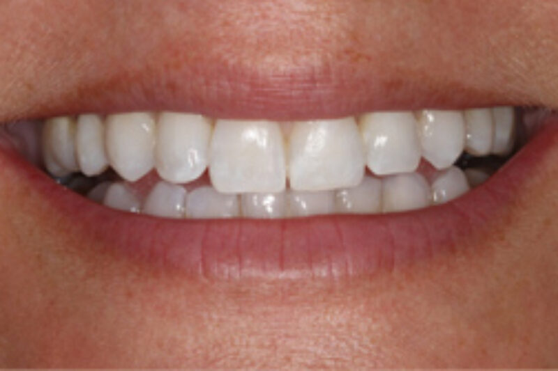 After - Cheadle Hulme Dental