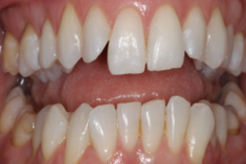 Before - Cheadle Hulme Dental