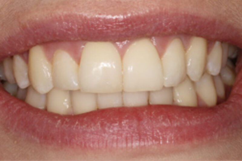 After - Cheadle Hulme Dental